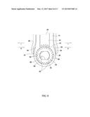 SURGICAL INSTRUMENT AND METHOD diagram and image