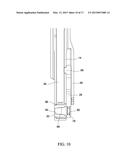 SURGICAL INSTRUMENT AND METHOD diagram and image