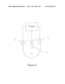 Pacing Methods, Systems and Computer Program Products for Using Feedback     Controlled Timing diagram and image