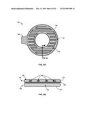 REMOVABLE HEAT MANAGEMENT FOR RECHARGE COILS diagram and image