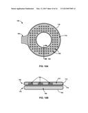 REMOVABLE HEAT MANAGEMENT FOR RECHARGE COILS diagram and image