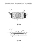 REMOVABLE HEAT MANAGEMENT FOR RECHARGE COILS diagram and image