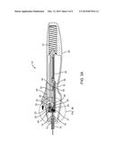 MANUAL ACTUATION SYSTEM FOR DEPLOYMENT OF IMPLANT diagram and image