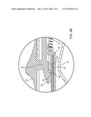 MANUAL ACTUATION SYSTEM FOR DEPLOYMENT OF IMPLANT diagram and image