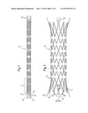 Implant with Attached Element and Method of Making Such an Implant diagram and image