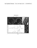 Assessment of a drug eluting bioresorbable vascular scafford diagram and image