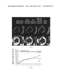 Assessment of a drug eluting bioresorbable vascular scafford diagram and image