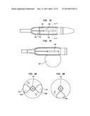 ALIGNMENT OF AN IMPLANTABLE MEDICAL DEVICE diagram and image