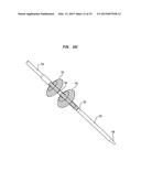 ALIGNMENT OF AN IMPLANTABLE MEDICAL DEVICE diagram and image