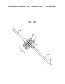 ALIGNMENT OF AN IMPLANTABLE MEDICAL DEVICE diagram and image