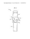 ALIGNMENT OF AN IMPLANTABLE MEDICAL DEVICE diagram and image