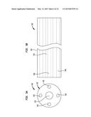 ALIGNMENT OF AN IMPLANTABLE MEDICAL DEVICE diagram and image