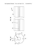 ALIGNMENT OF AN IMPLANTABLE MEDICAL DEVICE diagram and image