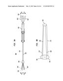 ALIGNMENT OF AN IMPLANTABLE MEDICAL DEVICE diagram and image