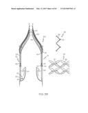 Repositionable Heart Valve and Method diagram and image