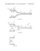 Repositionable Heart Valve and Method diagram and image