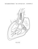 Repositionable Heart Valve and Method diagram and image