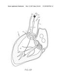 Repositionable Heart Valve and Method diagram and image