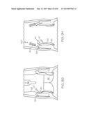 Repositionable Heart Valve and Method diagram and image