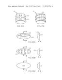 Repositionable Heart Valve and Method diagram and image