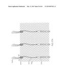 Repositionable Heart Valve and Method diagram and image