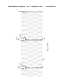 Repositionable Heart Valve and Method diagram and image