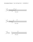 Repositionable Heart Valve and Method diagram and image