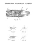 Repositionable Heart Valve and Method diagram and image