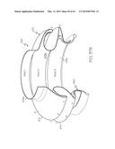 Repositionable Heart Valve and Method diagram and image