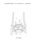 Repositionable Heart Valve and Method diagram and image