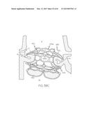 Repositionable Heart Valve and Method diagram and image