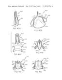 Repositionable Heart Valve and Method diagram and image