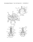 Repositionable Heart Valve and Method diagram and image