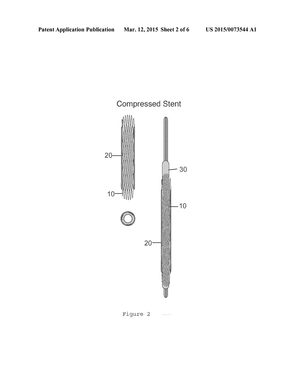 SUPERABSORBENT COATED STENTS FOR VASCULAR REDUCTION AND FOR ANCHORING     VALVE REPLACEMENTS - diagram, schematic, and image 03