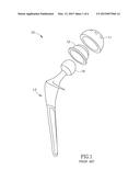 LINERS FOR MEDICAL JOINT IMPLANTS WITH IMPROVED WEAR-RESISTANCE diagram and image