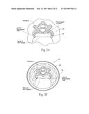 DEVICES, SYSTEMS, AND METHODS TO FIXATE TISSUE WITHIN THE REGIONS OF BODY,     SUCH AS THE PHARYNGEAL CONDUIT diagram and image