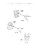 DEVICES, SYSTEMS, AND METHODS TO FIXATE TISSUE WITHIN THE REGIONS OF BODY,     SUCH AS THE PHARYNGEAL CONDUIT diagram and image