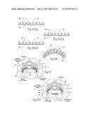 DEVICES, SYSTEMS, AND METHODS TO FIXATE TISSUE WITHIN THE REGIONS OF BODY,     SUCH AS THE PHARYNGEAL CONDUIT diagram and image