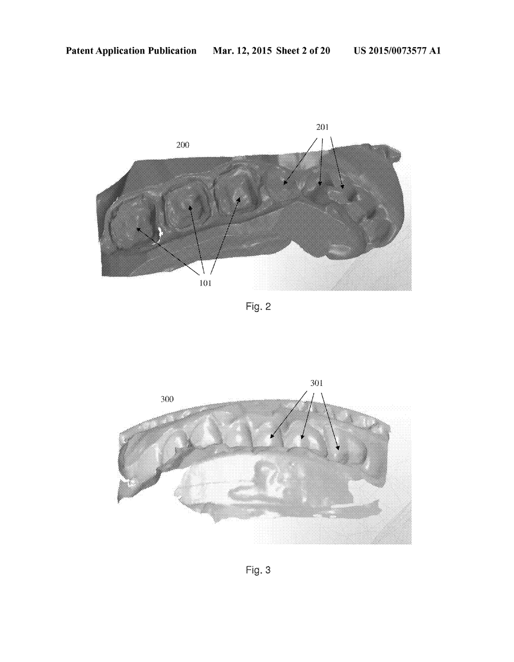 IMPRESSION SCANNING FOR MANUFACTURING OF DENTAL RESTORATIONS - diagram, schematic, and image 03