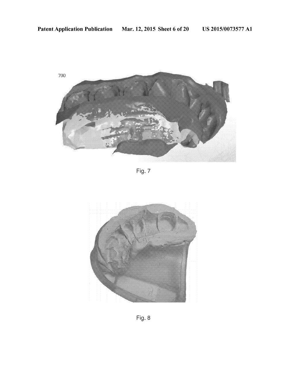 IMPRESSION SCANNING FOR MANUFACTURING OF DENTAL RESTORATIONS - diagram, schematic, and image 07