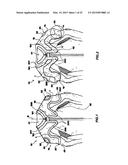 GARMENT ADAPTED TO BE ASSOCIATED TO A DEVICE FOR THE PERSONAL PROTECTION     OF A USER diagram and image