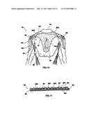 GARMENT ADAPTED TO BE ASSOCIATED TO A DEVICE FOR THE PERSONAL PROTECTION     OF A USER diagram and image