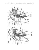 GARMENT ADAPTED TO BE ASSOCIATED TO A DEVICE FOR THE PERSONAL PROTECTION     OF A USER diagram and image