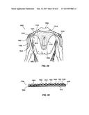 GARMENT ADAPTED TO BE ASSOCIATED TO A DEVICE FOR THE PERSONAL PROTECTION     OF A USER diagram and image