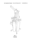 Nitrous Oxide Anesthetic Administration System diagram and image