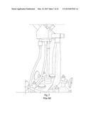 Nitrous Oxide Anesthetic Administration System diagram and image