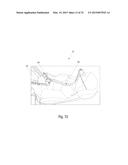 Nitrous Oxide Anesthetic Administration System diagram and image