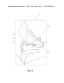 Nitrous Oxide Anesthetic Administration System diagram and image