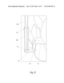 Nitrous Oxide Anesthetic Administration System diagram and image