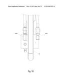 Nitrous Oxide Anesthetic Administration System diagram and image